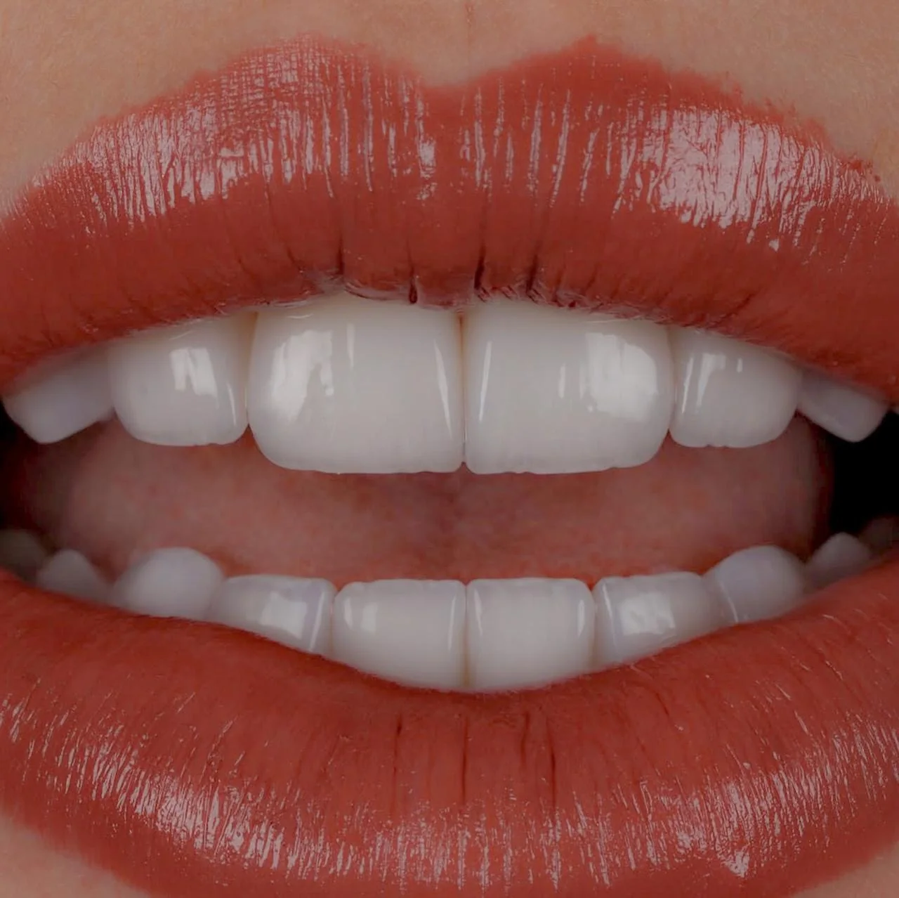 Detalhe de sorriso